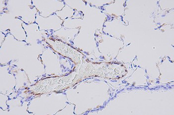 IHC-CD31.jpg IHC-CD31.jpg