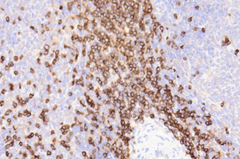 IHC-CD3.jpg IHC-CD3.jpg